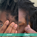 Sérum Boost & Scalp In Haircare