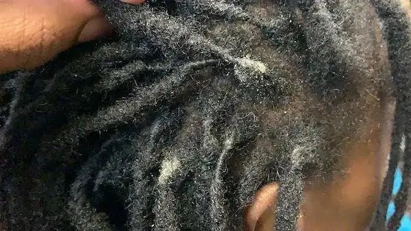 Le guide complet pour un décapage de locks efficace - My Pretty Locks